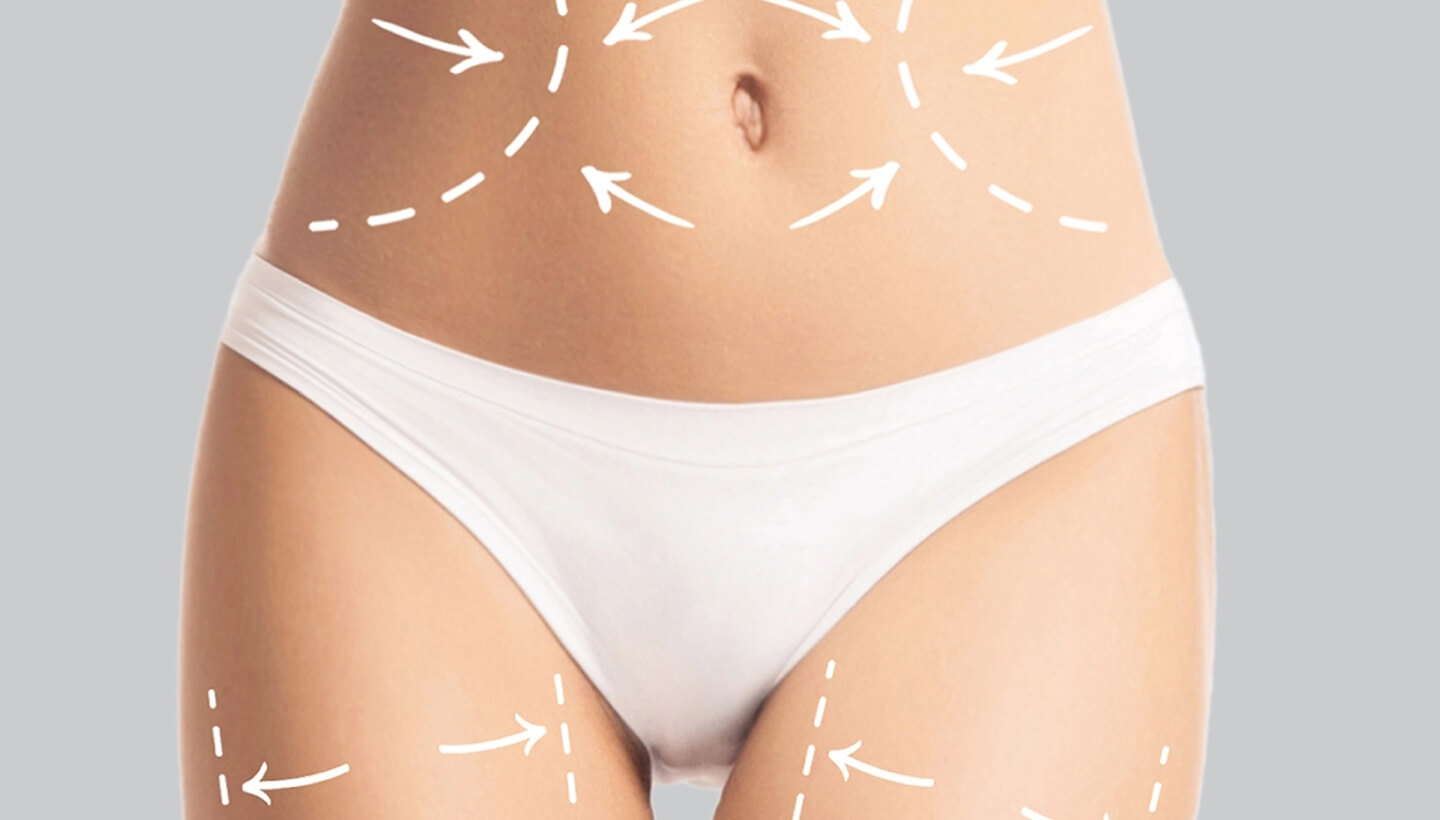 Persona in biancheria intima bianca con linee tratteggiate sulla pelle.