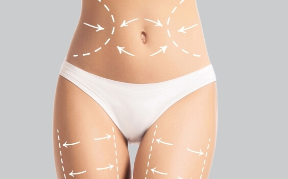 Person in weißer Unterwäsche mit gestrichelten Linien auf dem Bauch.